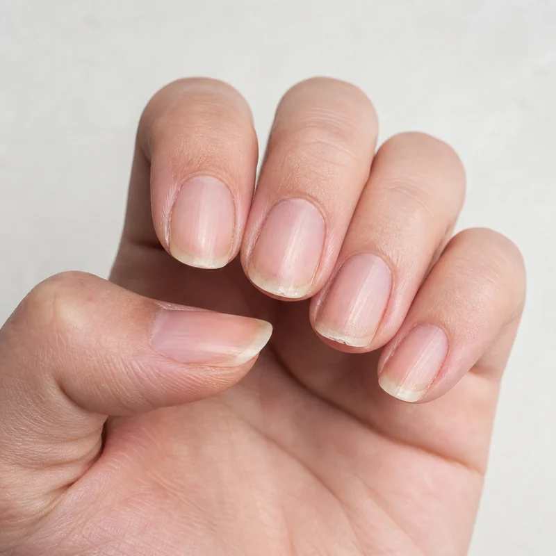 Nail health check before shaping showing minimum free edge length measurement and brittleness test for almond nail filing readiness